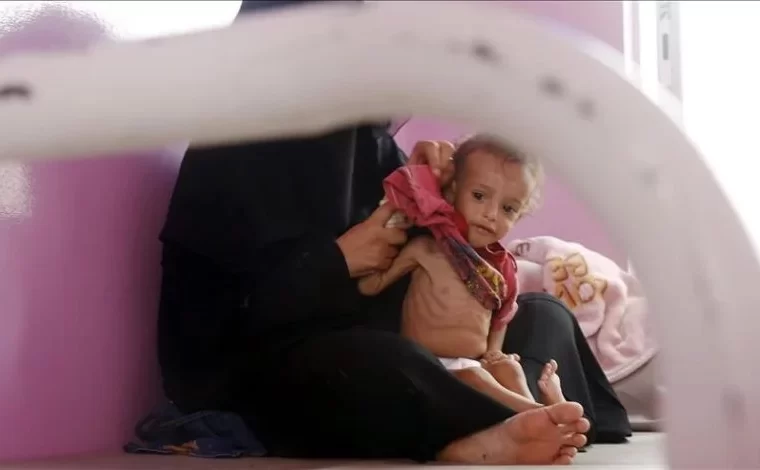نگرانی از کاهش کمک های برنامه جهانی غذای سازمان ملل به یمن