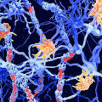 شناسایی دو زیرنوع جدید اماس با هوش مصنوعی و آزمایش خون شناسایی دو زیرنوع جدید اماس با هوش مصنوعی و آزمایش خون